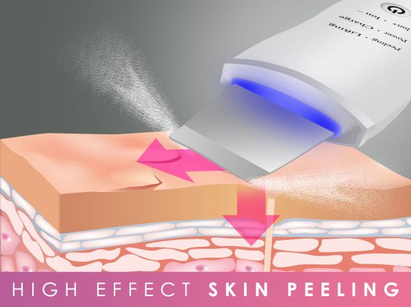 Kosmetický přístroj BeautyRelax Peel&Lift ultrazvuková špachtle