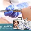 Diamantová mikrodermabraze BeautyRelax Peelmax Exclusive