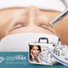 Diamantová mikrodermabraze BeautyRelax Peelmax Exclusive