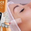 Masážní přístroj na vakuovou drenáž BeautyRelax Vacuform Professional