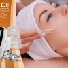 Masážní přístroj na vakuovou drenáž BeautyRelax Vacuform Professional