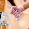 Masážní přístroj na vakuovou drenáž BeautyRelax Vacuform Professional