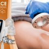 Masážní přístroj na vakuovou drenáž BeautyRelax Vacuform Professional