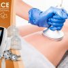 Masážní přístroj na vakuovou drenáž BeautyRelax Vacuform Professional