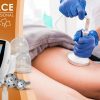 Masážní přístroj na vakuovou drenáž BeautyRelax Vacuform Professional