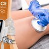 Masážní přístroj na vakuovou drenáž BeautyRelax Vacuform Professional