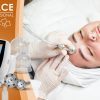 Masážní přístroj na vakuovou drenáž BeautyRelax Vacuform Professional