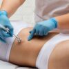 Diamantová mikrodermabraze BeautyRelax Peelmax Oxygen