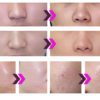 Kosmetický přístroj BeautyRelax PlasmaForce Professional Studio
