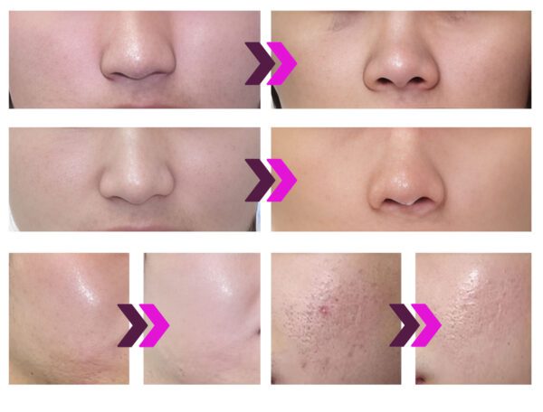 Kosmetický přístroj BeautyRelax PlasmaForce Professional Studio