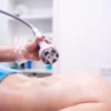 Masážní přístroj na celulitidu BeautyRelax Rollskin BodyShape Madero Professional Sculptor Elite