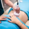 Masážní přístroj na celulitidu BeautyRelax Rollskin BodyShape Madero Professional Sculptor Elite