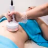 Masážní přístroj na celulitidu BeautyRelax Rollskin BodyShape Madero Professional Sculptor Elite