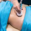 Masážní přístroj na celulitidu BeautyRelax Rollskin BodyShape Madero Professional Sculptor Elite