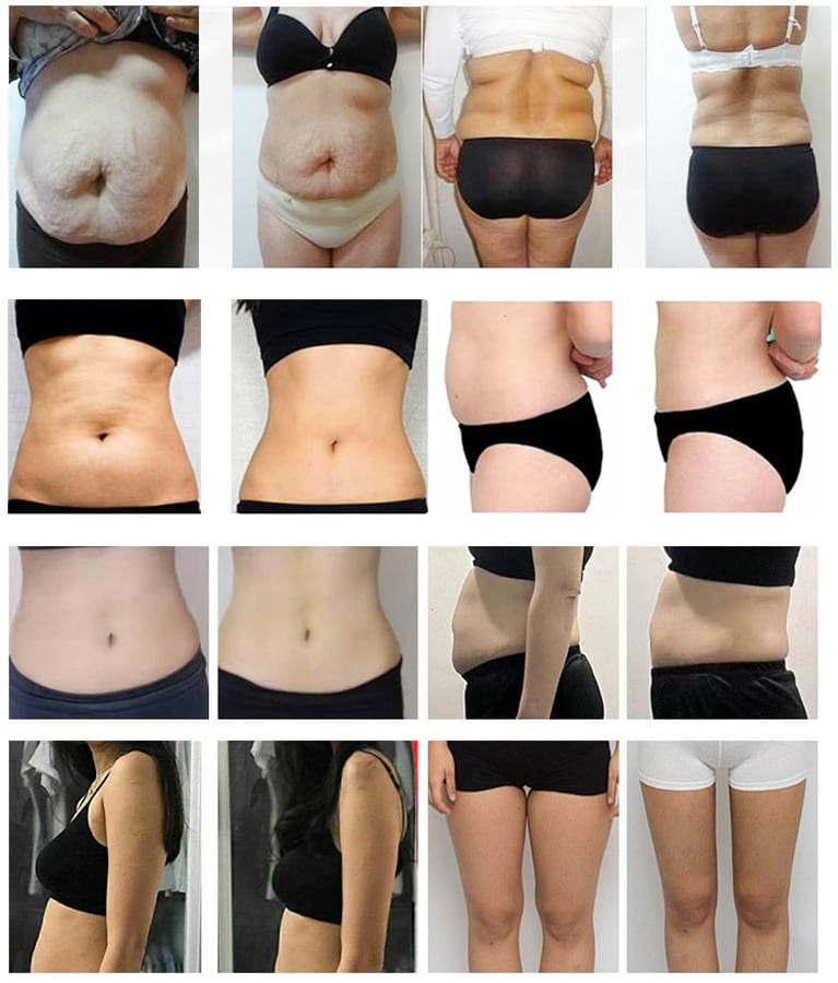 Estetický přístroj na formování postavy BeautyRelax Lipolaser Professional Studio EMS