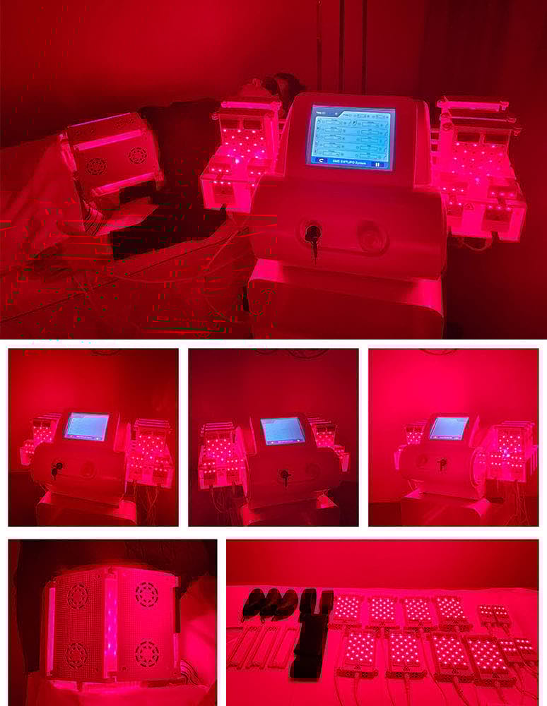 Estetický přístroj na formování postavy BeautyRelax Lipolaser Professional Studio EMS