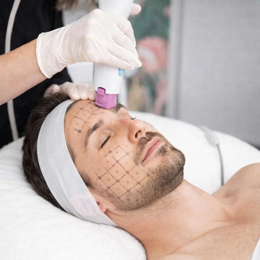 Estetický přístroj pro lifting pleti BeautyRelax Fraxlift Studio Performance - Obrázek 5