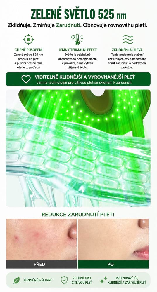 Kosmetický přístroj s fotonovou terapií BeautyRelax Lightmask Elite Pro - Obrázek 11
