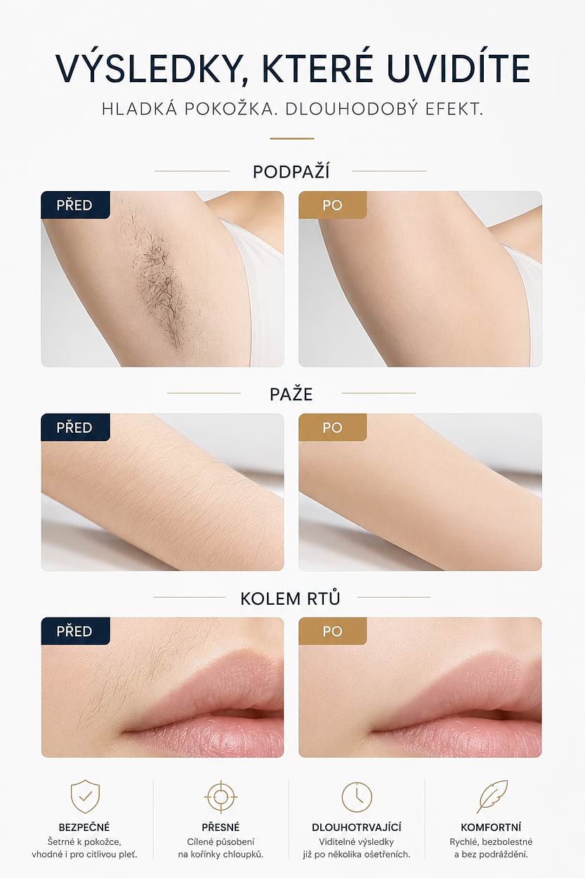 Estetický multifunkční přístroj BeautyRelax Studio Supreme - Obrázek 7
