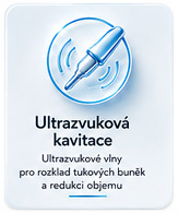 Ultrazvuková kavitace