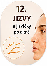 top-12 podpora tvorby kolagenu